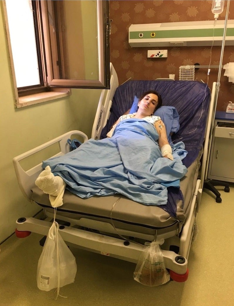 Payman Thalib Thaher lost her left leg in the Turkish airstrike at Kuna Masi water resort on June 25, 2020.