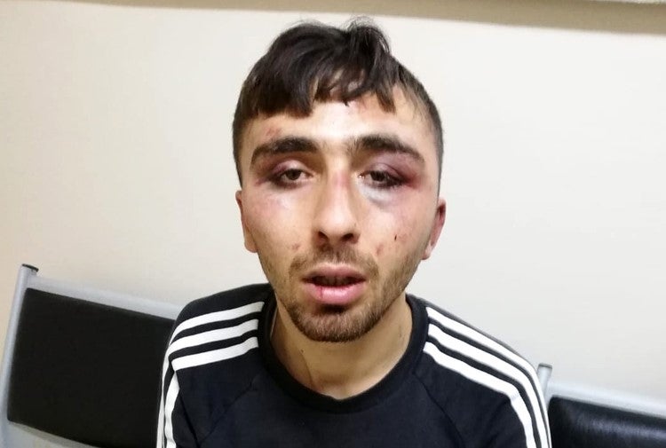 B. Y., Aralık ayında polisin onu gözaltına aldığını ve bir polis karakoluna götürürken dövdüğünü iddia ediyor. 
