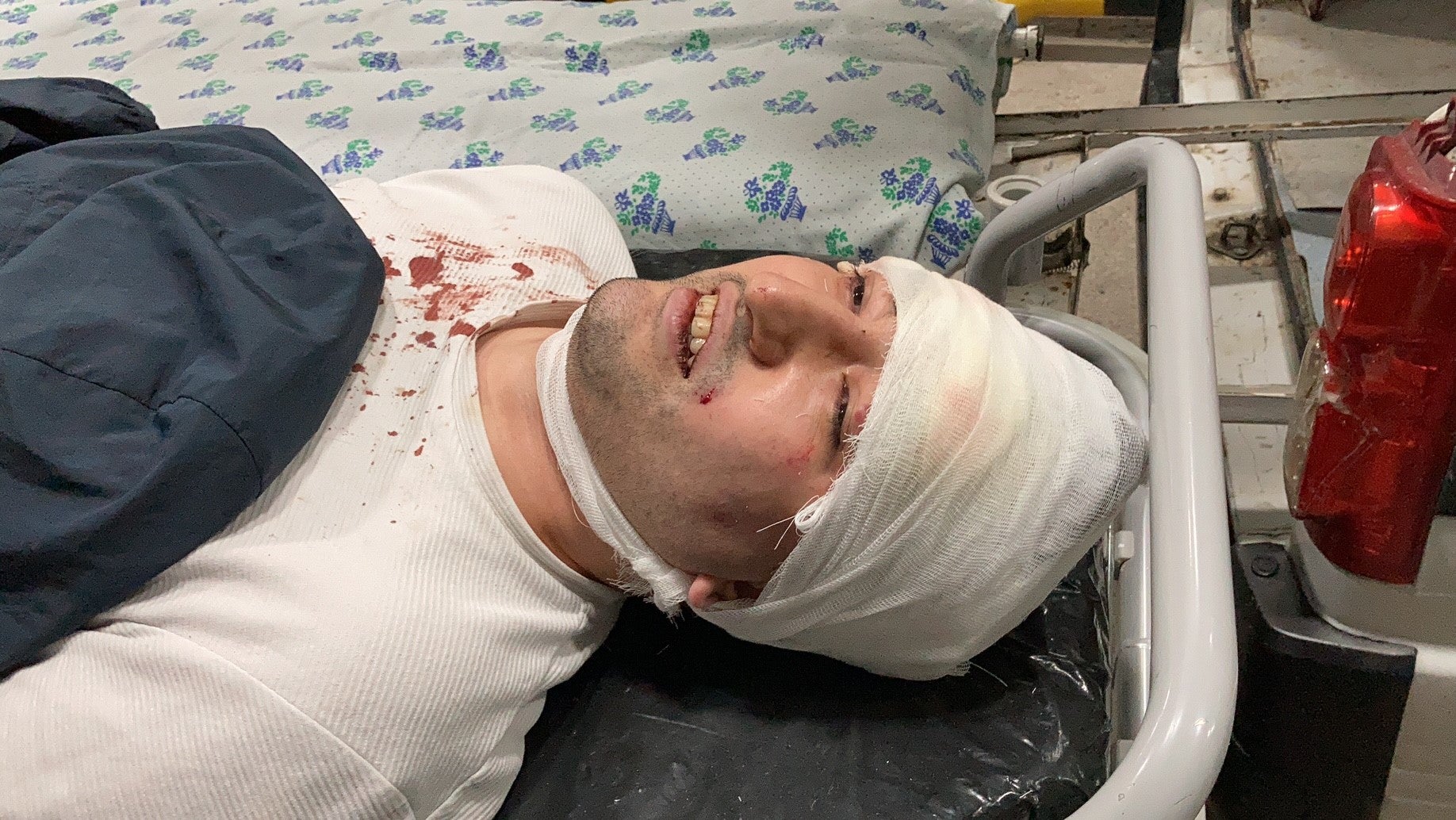 Miraziz Bazarov at a hospital in Tashkent after the attack on March 28.