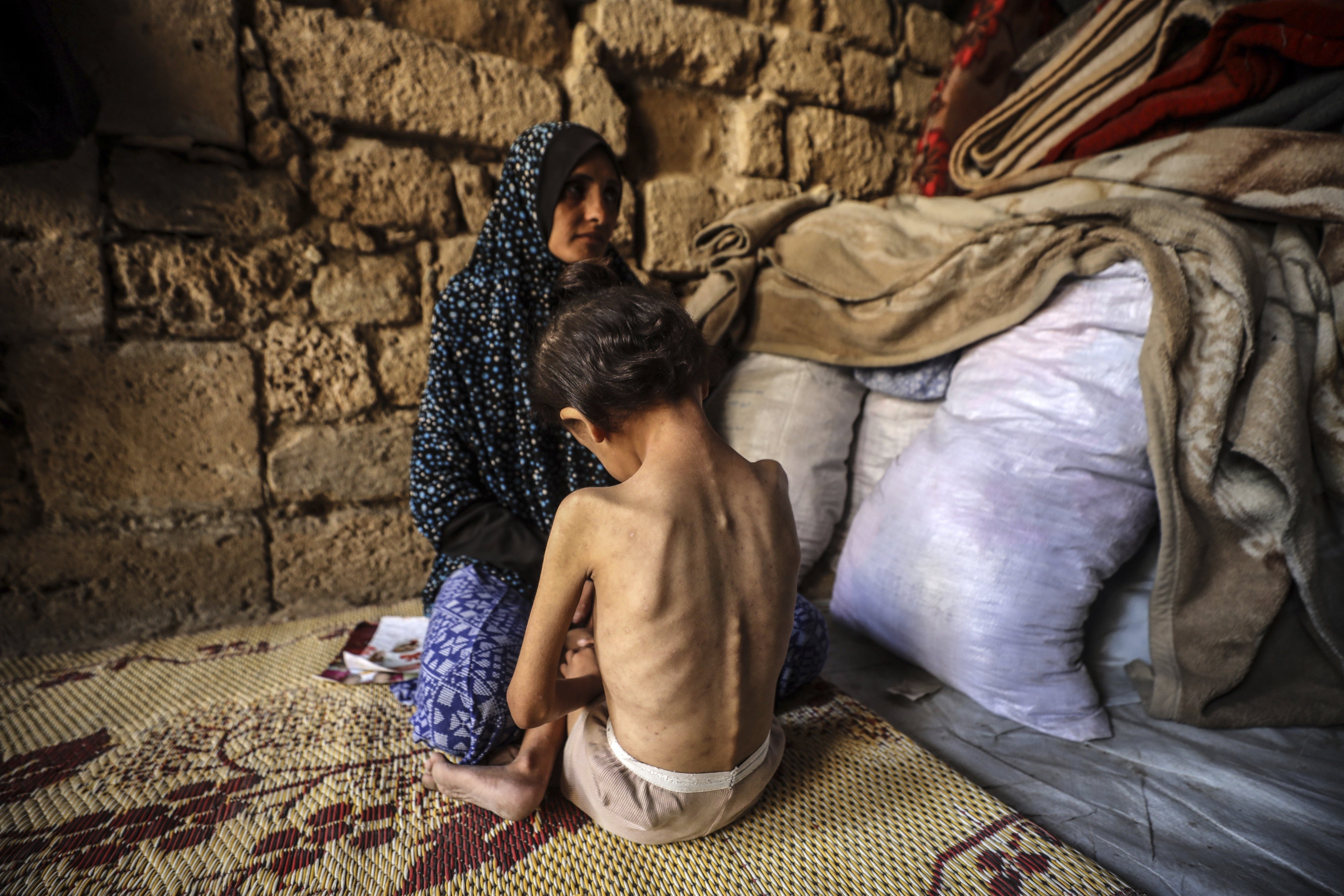 Eine Frau tröstet ihre 6-jährige Tochter, die unterernährt ist, in einer Notunterkunft im Zentrum von Gaza-Stadt am 11. Mai 2025.