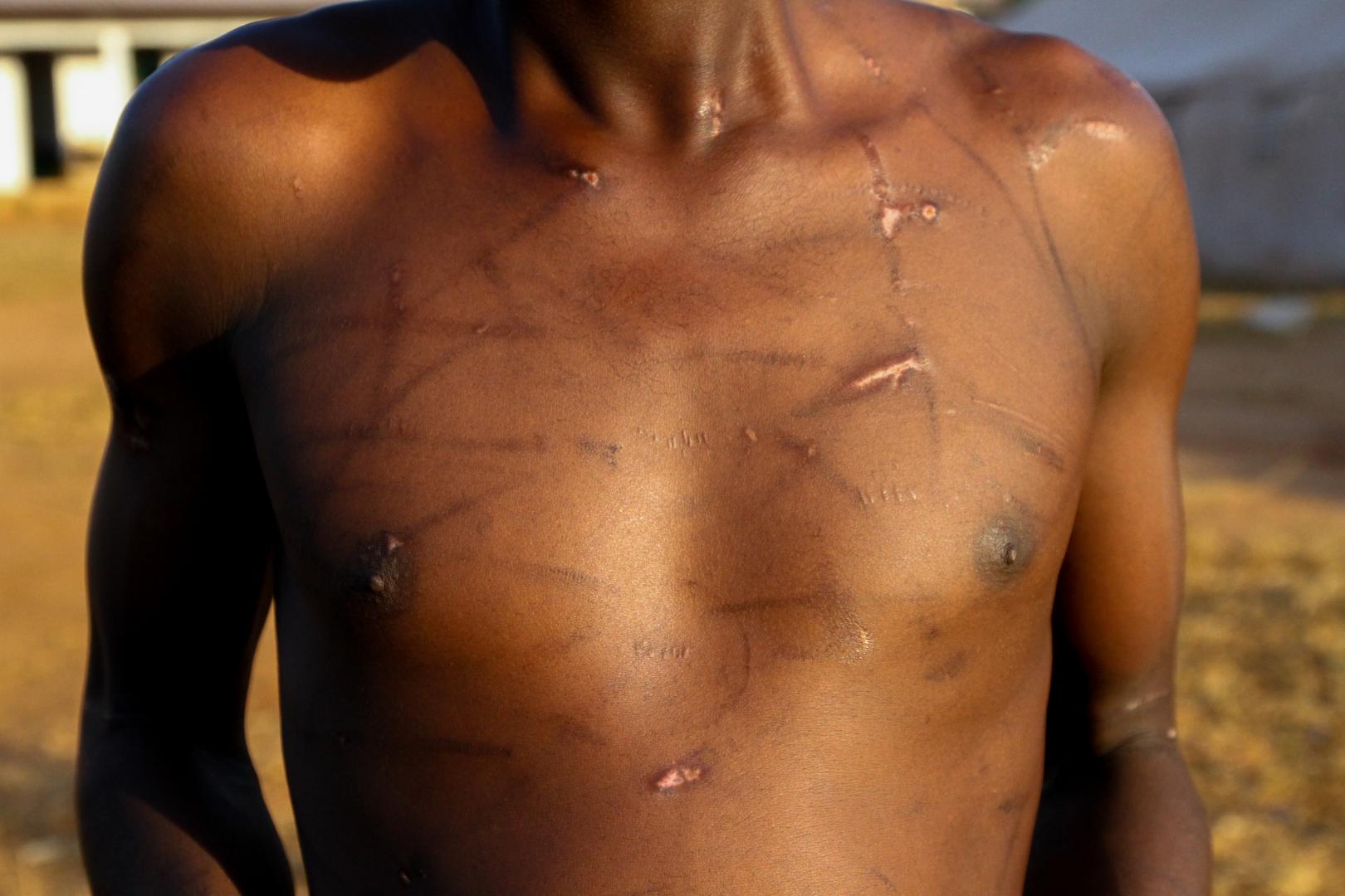 « Claude », 21 ans, a déclaré que des combattants du groupe rebelle 3R l'ont torturé à De Gaulle, en République centrafricaine, après que le groupe s'est emparé de la ville fin septembre. 