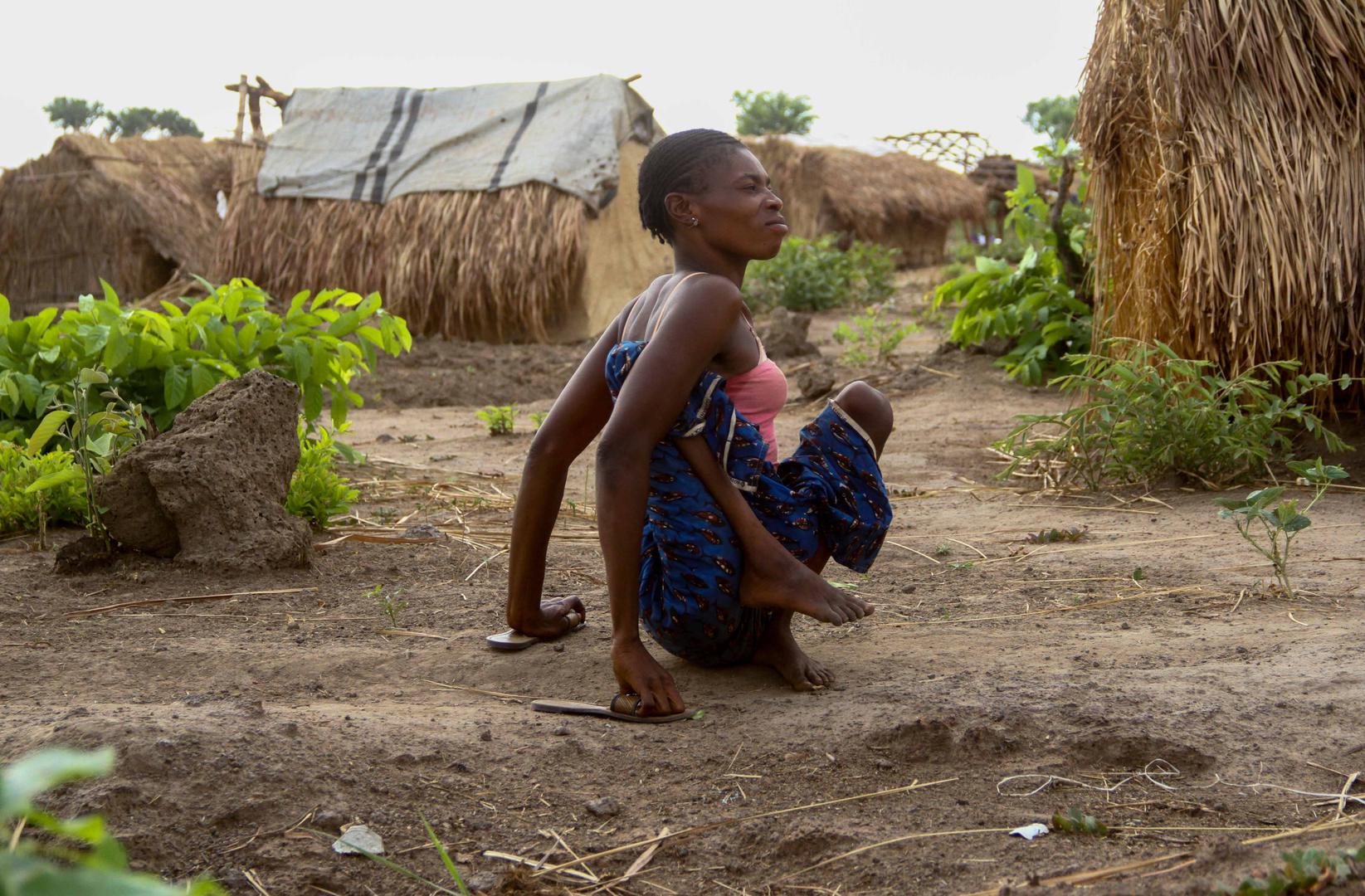 “Jeanette,” a 27-year-old polio survivor, in the “MINUSCA” camp in Kaga-Bandoro. “I do not have a wheelchair and I have to use shoes on my hands to move around,” she told Human Rights Watch.