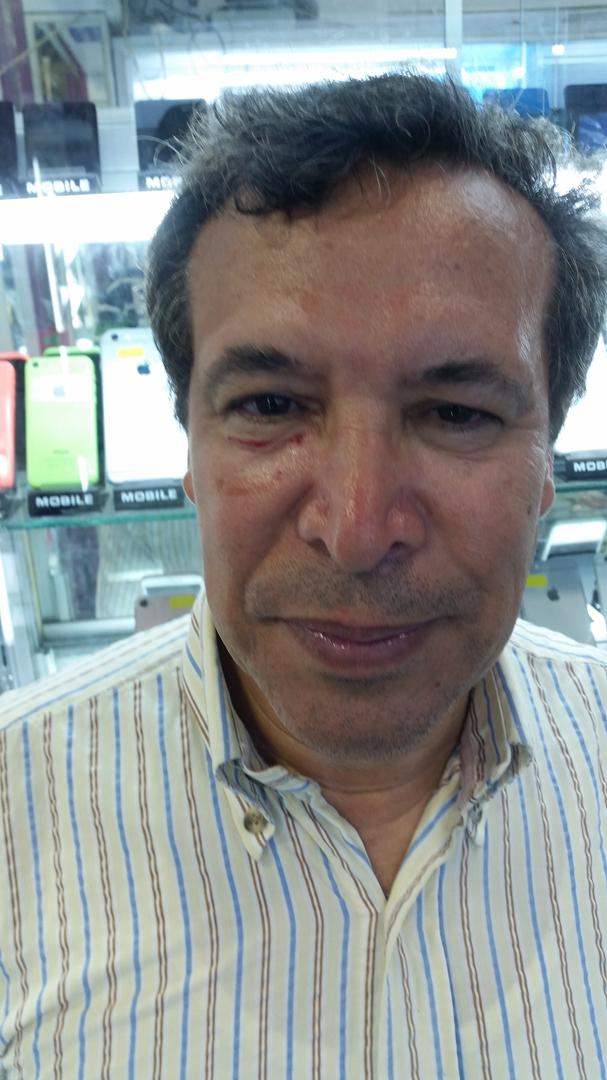 L'avocat marocain Abdelaziz Nouaydi, après avoir été frappé au visage par un policier lors de la dispersion violente d’un sit-in à Rabat.