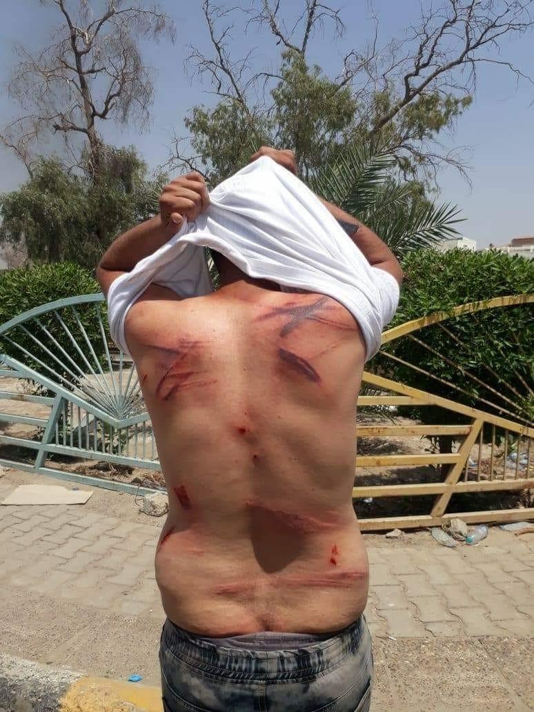 ظهر رجل اشترك في المظاهرات يوم 15 يوليو/تموز أمام مكتب محافظ البصرة. قال إن قوات مكافحة الشغب اعتقلته وضربته عدة مرات بأنابيب معدنية وكابلات بلاستيكية. © 2018 خاص