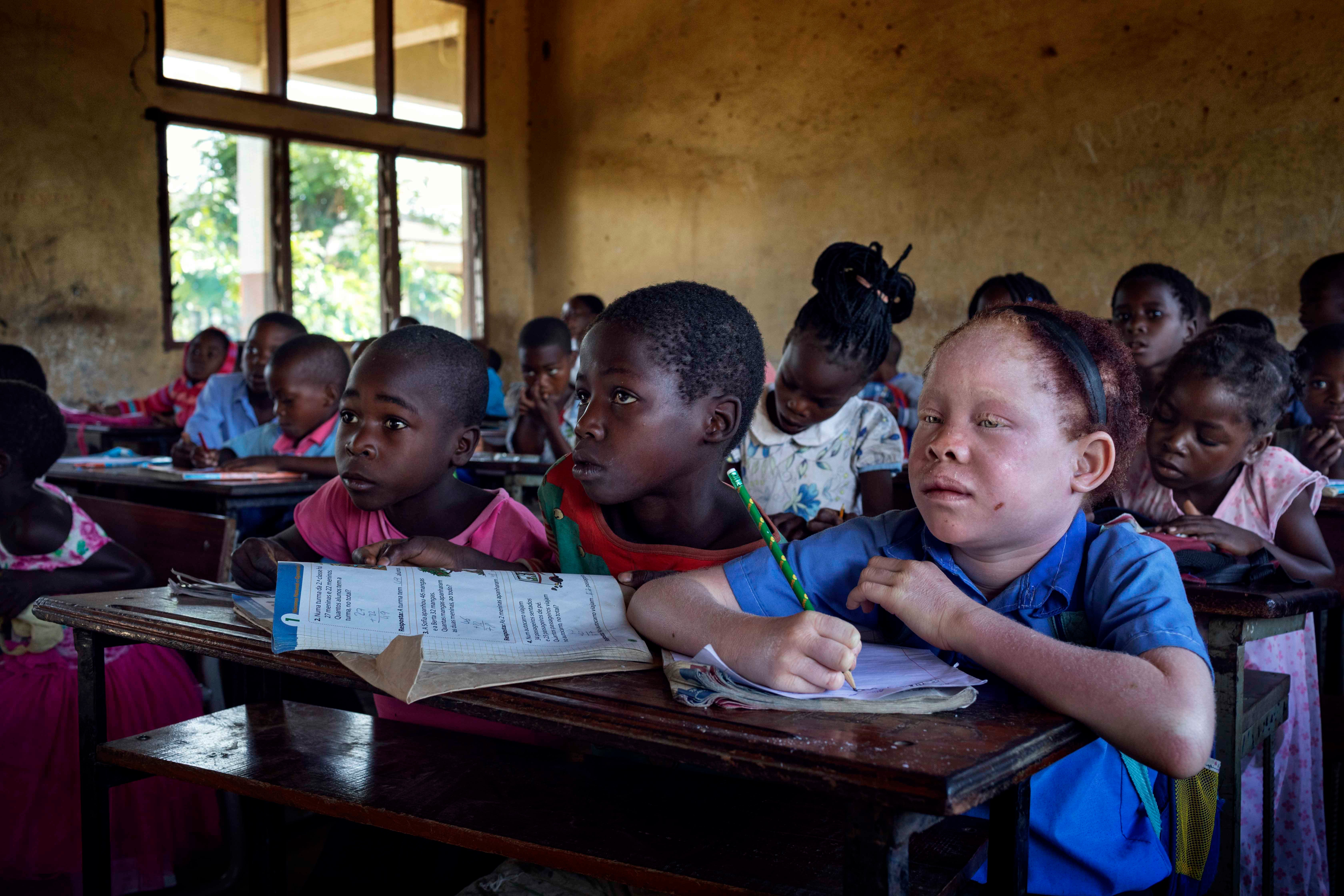 Josina, een Mozambikaans meisje met albinisme, zit in de klas in het district Chiuta in de provincie Tete. 