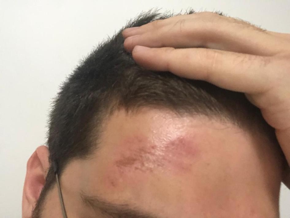 A soldier hit journalist Timour Azhari on the head with a stick.