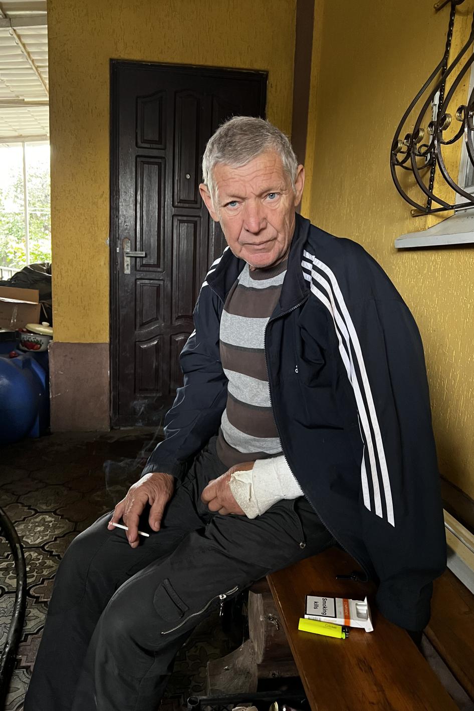 Mykhailo Ivanovych, de 67 años, fue retenido a finales de agosto de 2022 durante 12 días. Un soldado le rompió el brazo izquierdo al golpearle con lo que Mykhailo Ivanovych creyó que era un tubo de plástico, en Izium, Ucrania, 23 de septiembre de 2022