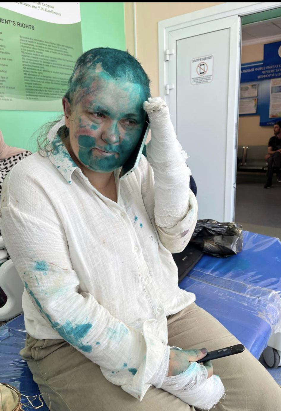 Elena Milashina, photographiée le 4 juillet 2023 dans un hôpital de Grozny, la capitale de la république de Tchétchénie en Russie, après avoir été violemment agressée plus tôt dans la journée.