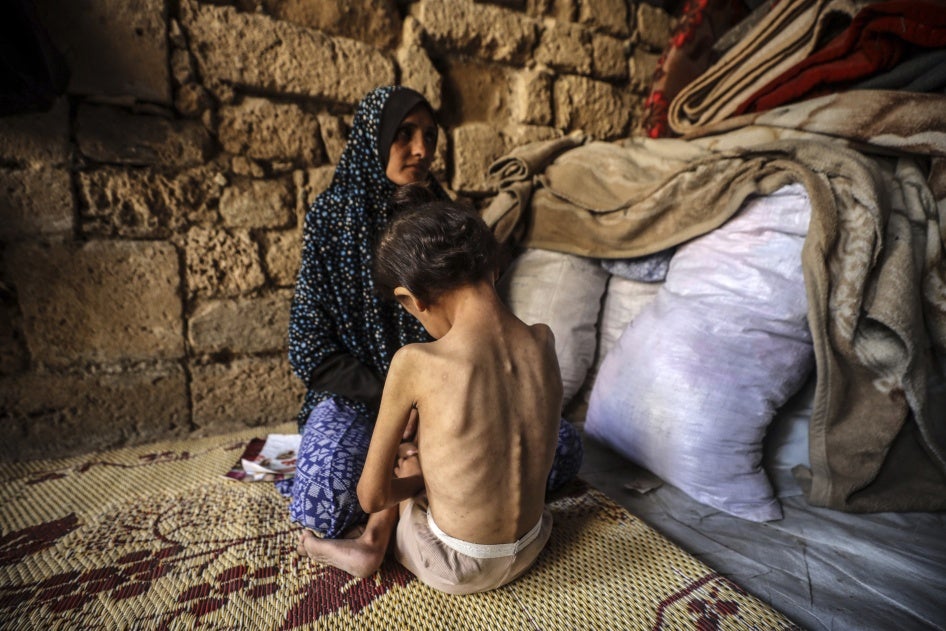 Eine Frau tröstet ihre 6-jährige Tochter, die unterernährt ist, in einer Notunterkunft im Zentrum von Gaza-Stadt am 11. Mai 2025.