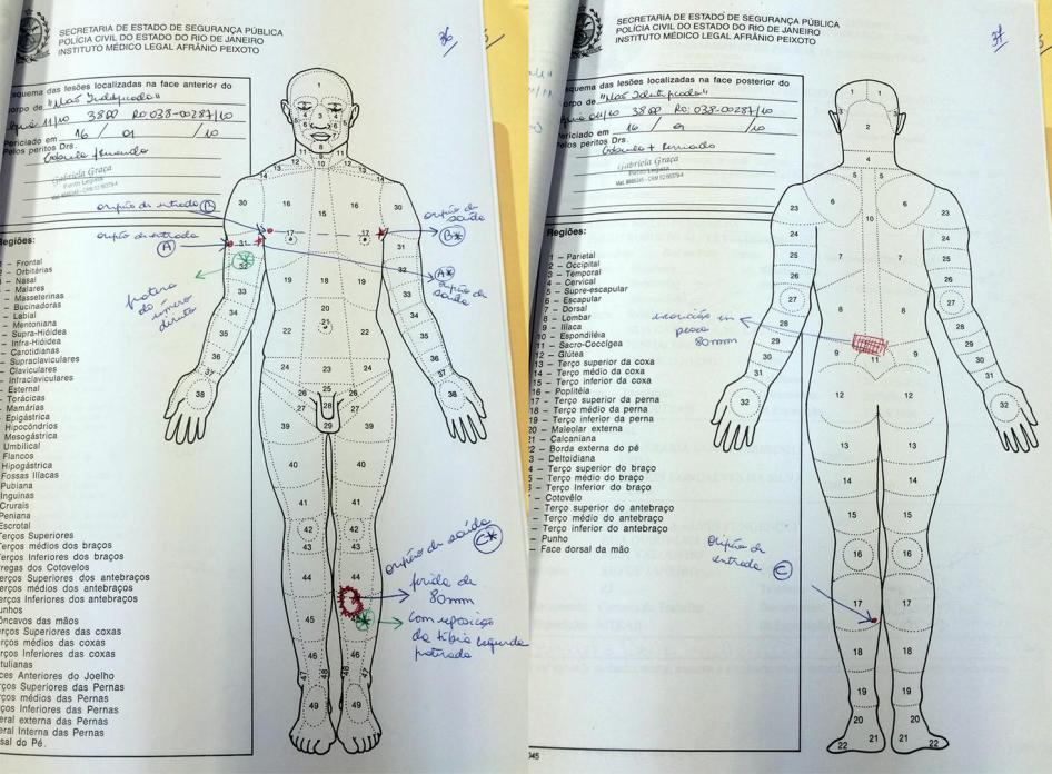 A autópsia de Caio Abílio Fulgêncio mostra que ele levou um tiro na parte traseira da perna (marcado como ‘C’) que deixou um orifício de oito centímetros ao sair, além de dois tiros próximos