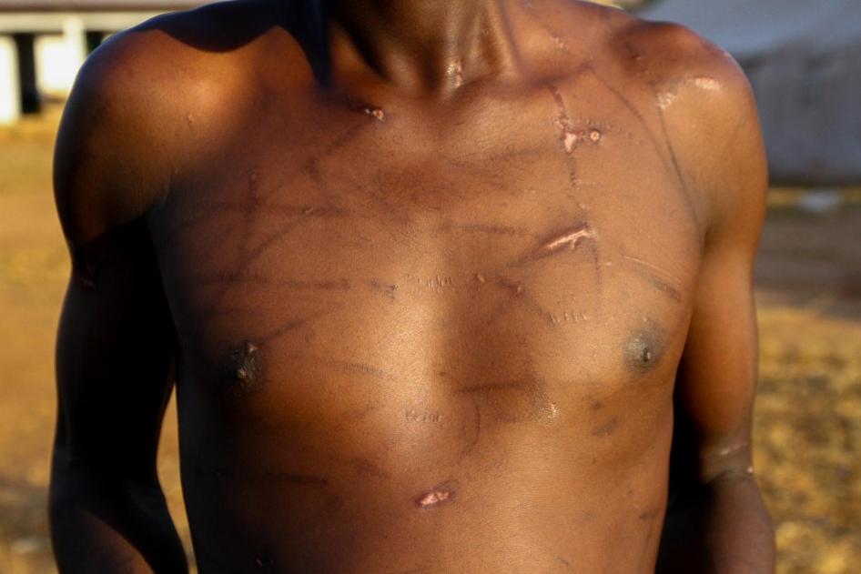« Claude », 21 ans, a déclaré que des combattants du groupe rebelle 3R l'ont torturé à De Gaulle, en République centrafricaine, après que le groupe s'est emparé de la ville fin septembre. 