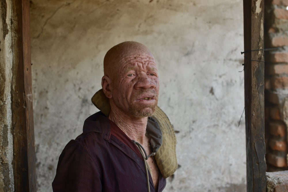 David Issa, 50, from Mangochi, Malawi. 