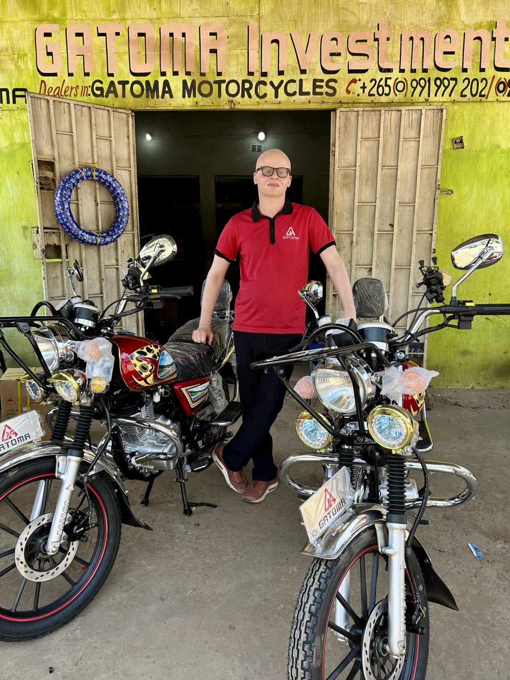 Ian Simbota, a prominent Malawian disability rights activist and the former president of the Association of Persons with Albinism in Malawi (APAM).