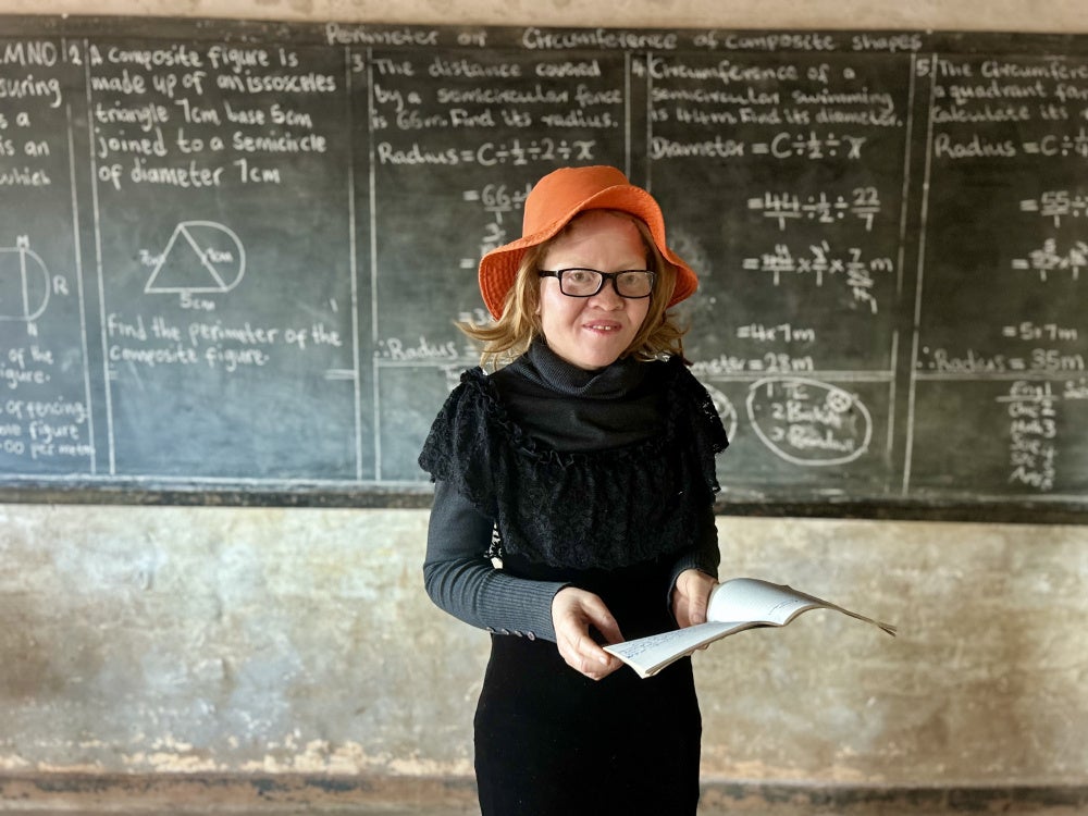 Rabecca Pengani, 25, described being asked to leave a job interview after her appearance revealed she had albinism.