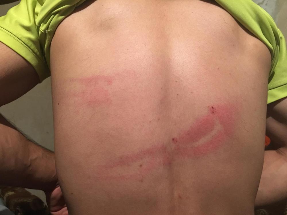 Unidentified men cooperating with Armenian police beat cameraman David Harutyunyan with a wooden club and destroyed his video camera as he filmed the violent police dispersal in the Erebuni district of Yerevan on July 29, 2016. 