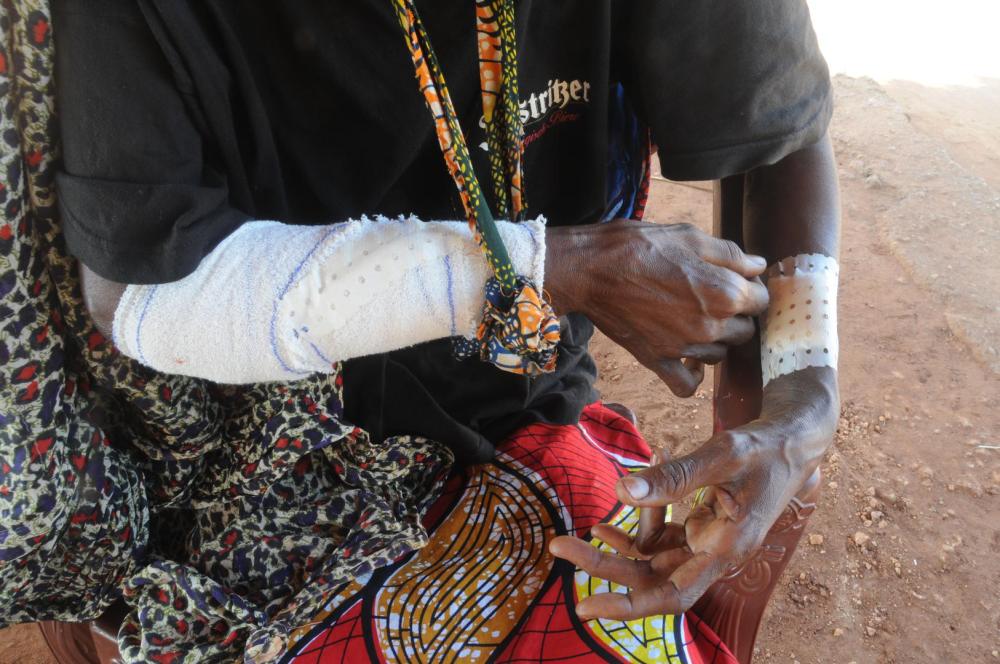 The only known surivivor, a 40-year-old woman, of an attack on nine Peuhl civilians at Golaga village on November 26. From the group of nine, five were killed and three are missing. 