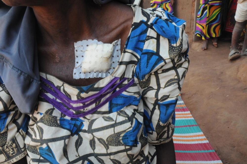 FPRC fighters shot this 66-year-old Peuhl woman in the back as she tried to protect her son who they shot and killed in Gobolo on November 21. 