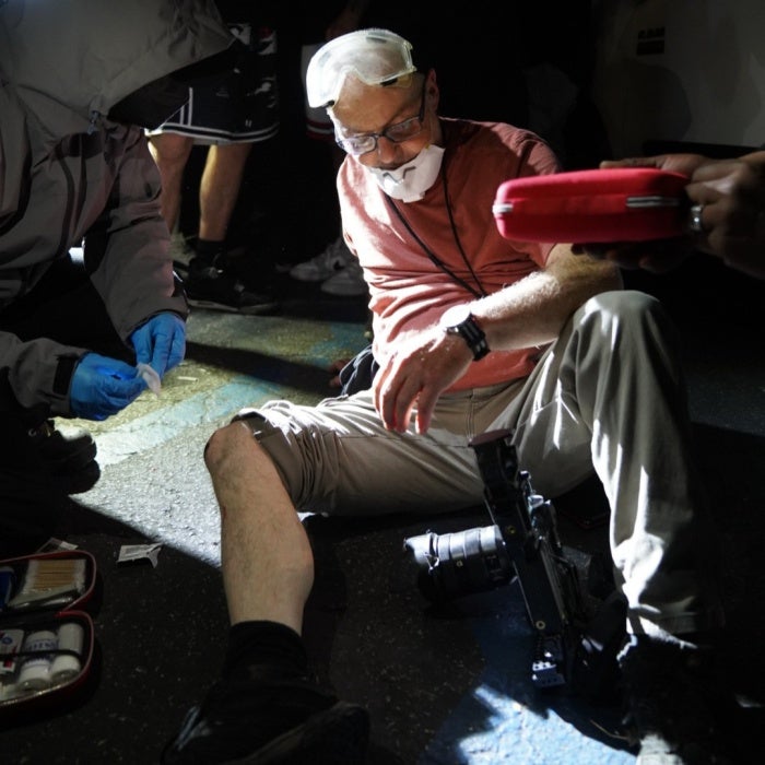 Photo of a wounded man sitting on the ground